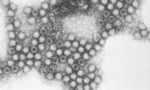 Calciviromes u koček: je snadnější varovat než léčit